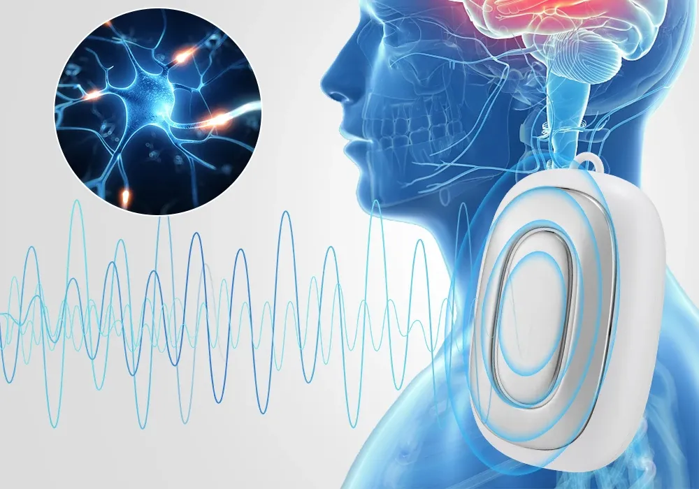 Ilustração do trajeto do nervo junto à orelha, ao lado do dispositivo NeuroVago em uso